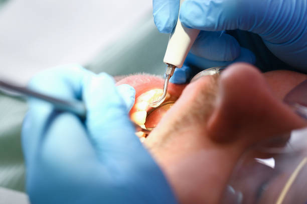 Best Pediatric Emergency Dentist in Waupun, WI